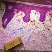 A light microscopy view of skin tissue shown as a map. A box of push pins are labeled Immune Cells. Pins are attached to areas in the dermis.