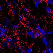 Microscopic image of star-shaped brain cells, called astrocytes (red)