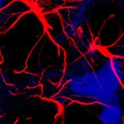 Microscopic image of star-shaped brain cells, called astrocytes (red)