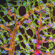 Breathing tubes embedded in the weblike sheath cells that cover developing egg chambers in a lubber grasshopper.