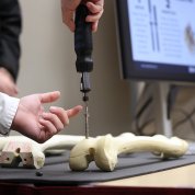 A human hand holds a human bone and uses a surgical screwdriver to insert a specialized screw into the bone. 