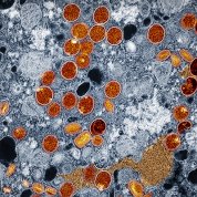 Colorized transmission electron micrograph of mpox virus particles (red and yellow) found within infected VERO E6 cells (blue).