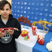 A child holds up 3D-printed skeletal arm and hand, surrounded by other medical as well as dinosaur creations
