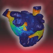 Multicolored anatomical model of a human heart