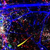 Thick blue webbing around white and green splotches, and a small circle in the middle