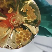 A researcher holds a flask containing human cerebral organoids.