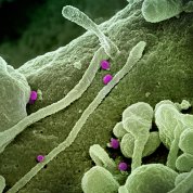 Colorized scanning electron micrograph of Crimean-Congo hemorrhagic fever (CCHF) virus particles