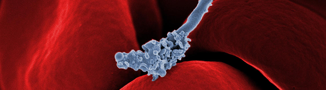 A bacterium interacting with red blood cells