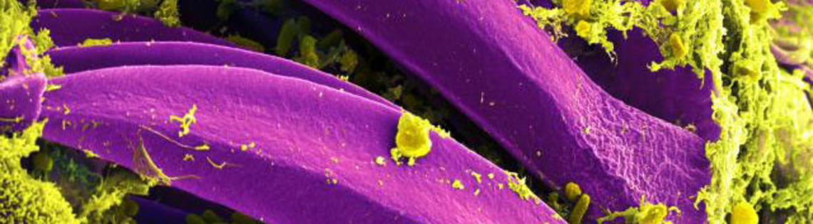 scientific image vibrant purple petal-shaped rods coated with yellow-green flaky strands