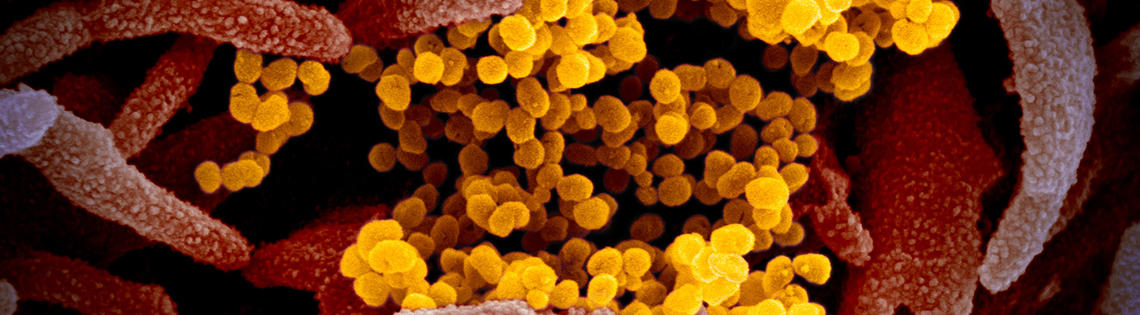 scientific image of coronavirus bubbles and tubes in yellows, browns, pinks
