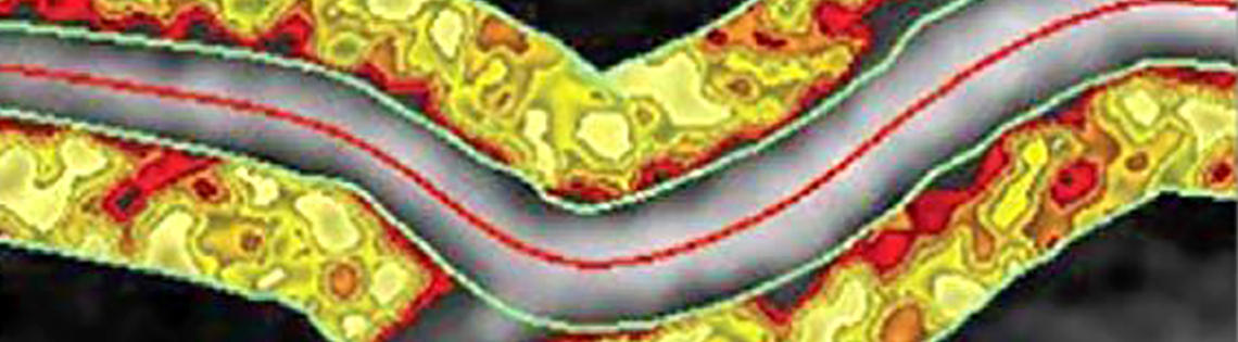 Scientific image of curved yellow tube with a road-like band of gray running horizontally through it. The "road" of gray is bisected by a red line.