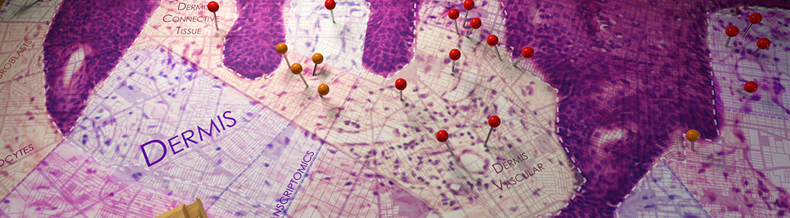 A light microscopy view of skin tissue shown as a map. A box of push pins are labeled Immune Cells. Pins are attached to areas in the dermis.