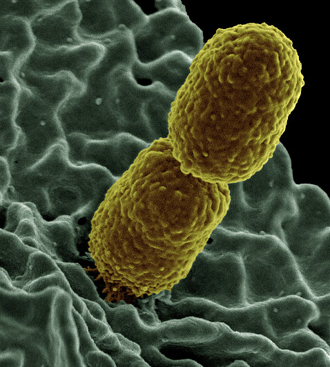 Two mustard-colored, rod-shaped carbapenem-resistant Klebsiella pneumoniae (CRKP) bacteria interacting with green-colored, human white blood cells.