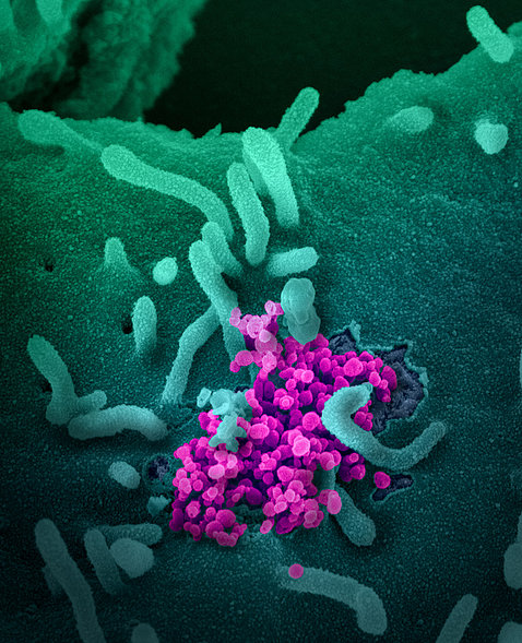 A microscopic image of SARS-CoV-2, the virus that causes Covid-19