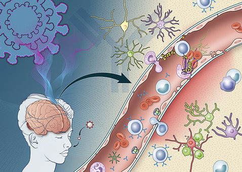 An illustration shows a human brain with an arrow to a close-up of round molecules penetrating vessels in the brain, which then clump and cluster. 