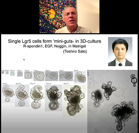 screenshot from lecture showing growth progression of the first “mini-guts” from single stem cell to organoid