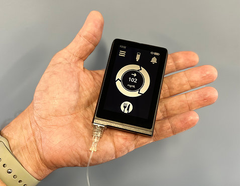 a small electronic device, black with goal dial, rests in a hand