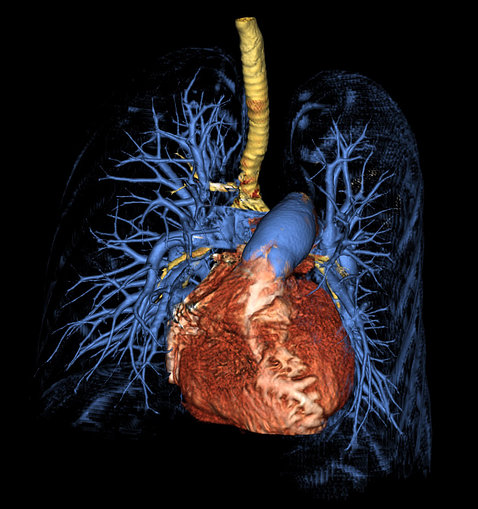 Heart and lungs, with a network of blue strands protruding