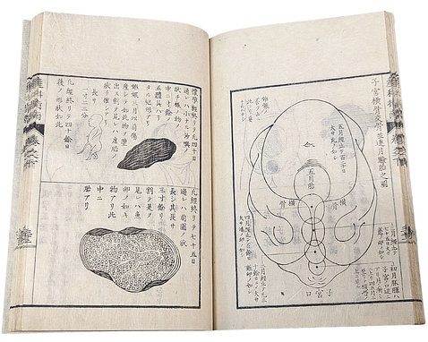 An open book showing medical diagrams with Japanese writing