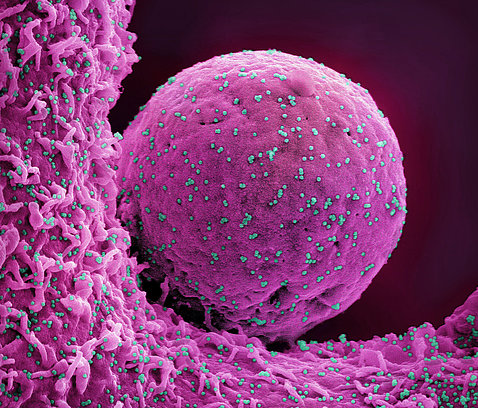Colorized scanning electron micrograph of a cell (pink) infected with the Omicron strain of SARS-CoV-2 virus particles