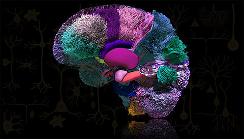 A photo shows brain regions in bright colors against a black background
