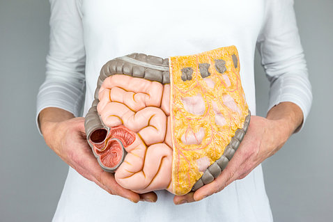 A person in a white shirt holds a model of the large intestine in front of their torso.