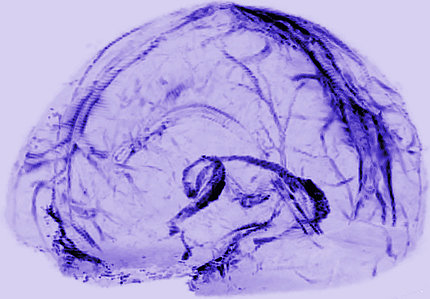 Image of brain vessels