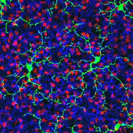 Microglia (green) shown in a mouse retina