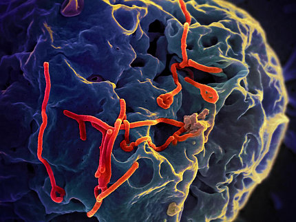 Ebola virus particles on a larger cell.