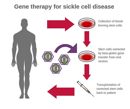 A graphic illustrating the steps for the new SCD treatment 