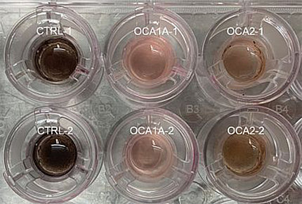 Six petri dishes, one pair with ball of dark brown cells inside, one pair with light brown, the third pair with tan 