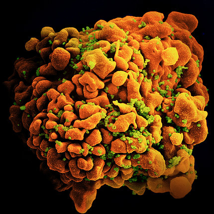 Enlarged view of HIV-infected H9 T cell
