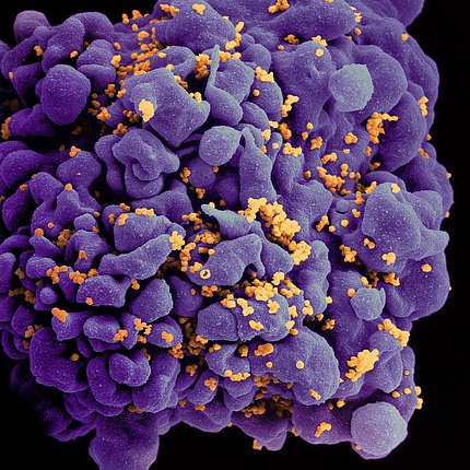 Scanning electron micrograph of an HIV-infected H9 T cell, colorized in purple, gold, and orange.