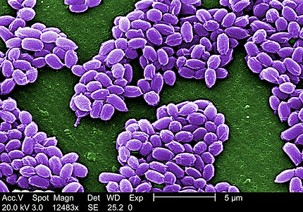 This scanning electron micrograph shows spores from the anthrax vaccine strain of Bacillus anthracis.