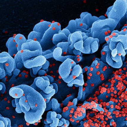 Many clusters of small red balls (Covid particles) around human tissue (blue)