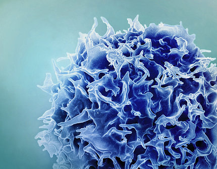 Colorized scanning electron micrograph of a T lymphocyte  (also known as a T cell) (blue)