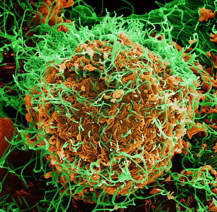 Colorized scanning electron micrograph of Ebola virus particles