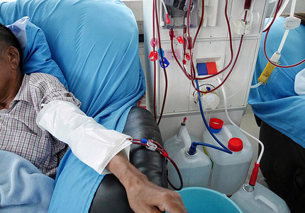 The arm extended of a patient in a hospital bed with protruding wires from the dialysis machine.