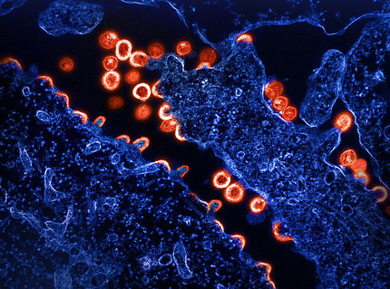 A microscopic image of HIV-1 virus particles