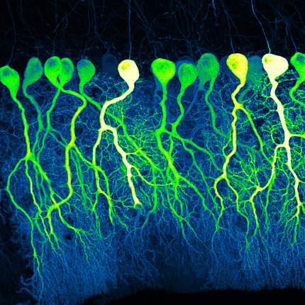 scientific image of brains cells resembling a line of green, yellow, and cream-colored balloons on strings floating in a black background