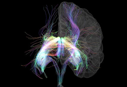 scientific image of the brain with white gossamer-like circuitry 