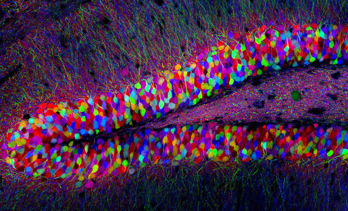 A psychedelic slice of a mouse brain
