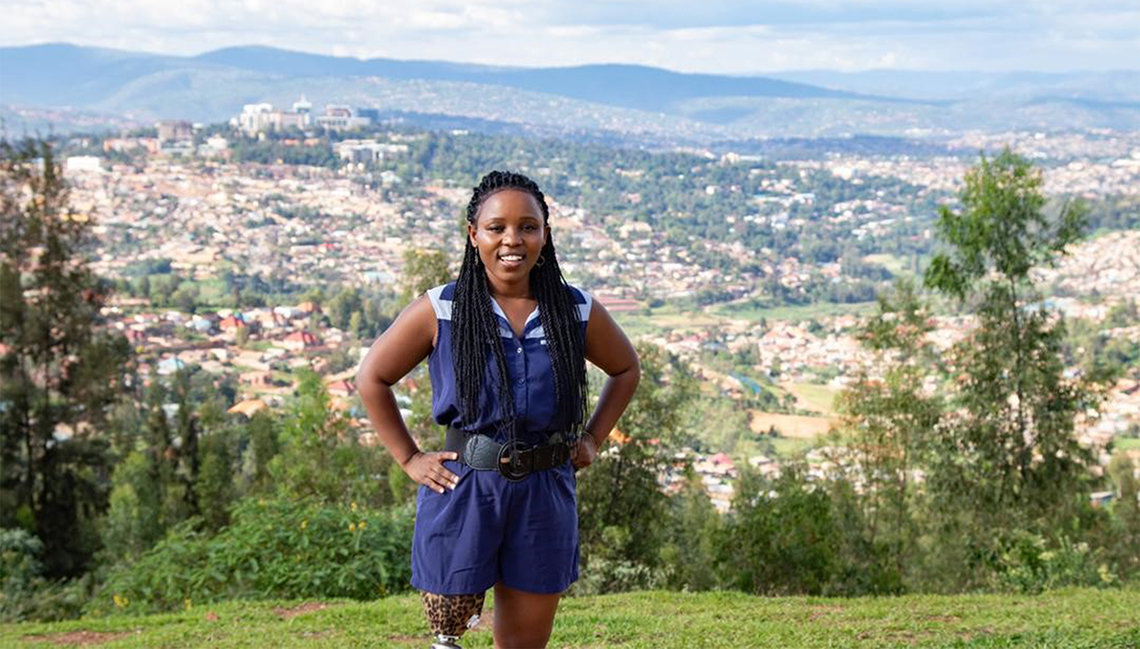 Humure stands, hands on hip, part of prosthetic leg showing beneath shorts, with mountainous view in Rwanda behind her