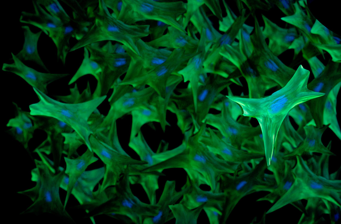 Scientific image showing green, spiky substance lined with bright blue ovals