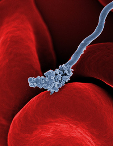A bacterium interacting with red blood cells