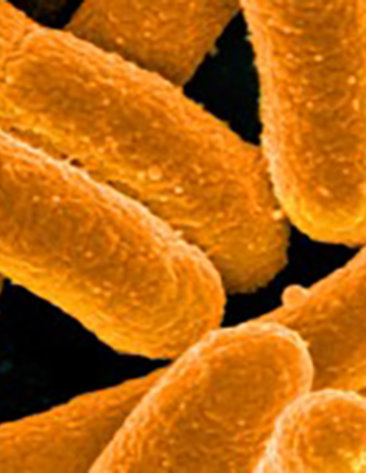 E-coli bacteria appear as wide, yellow rods against black background