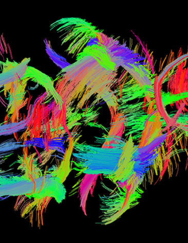 Colorful wispy fibers set against a black background