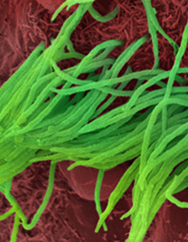 scientific image of green spaghetti-like strands on bed of red