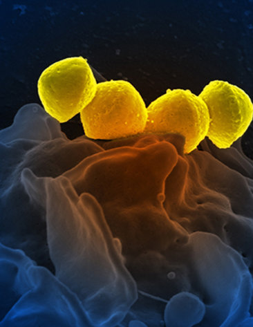 Streptococcus pyrogenese bound to a human neutrophil 