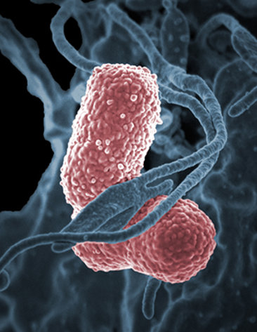 Grayish-colored strands of neutrophil wrap around klebsiella bacterium, shown in pink.